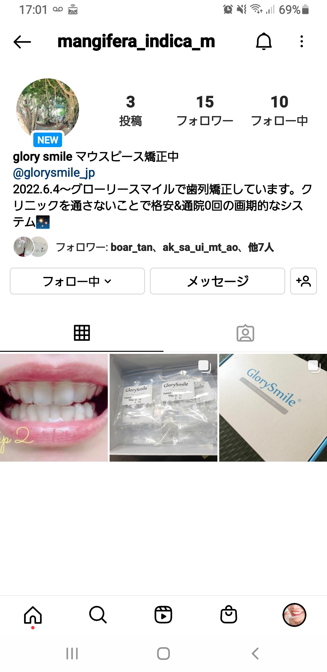 グローリースマイルで歯列矯正しています。