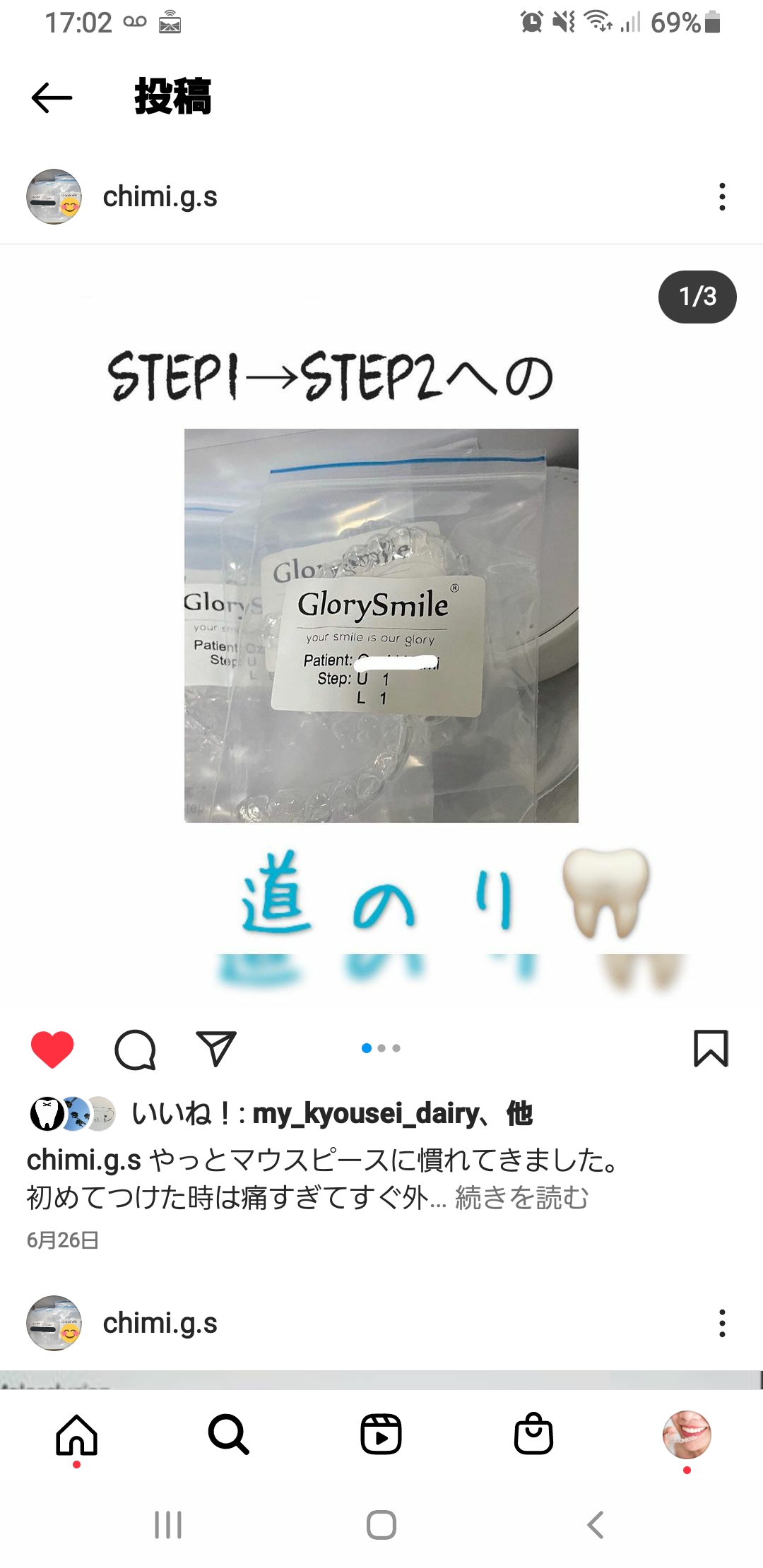 やっとマウスピースに慣れてきました。