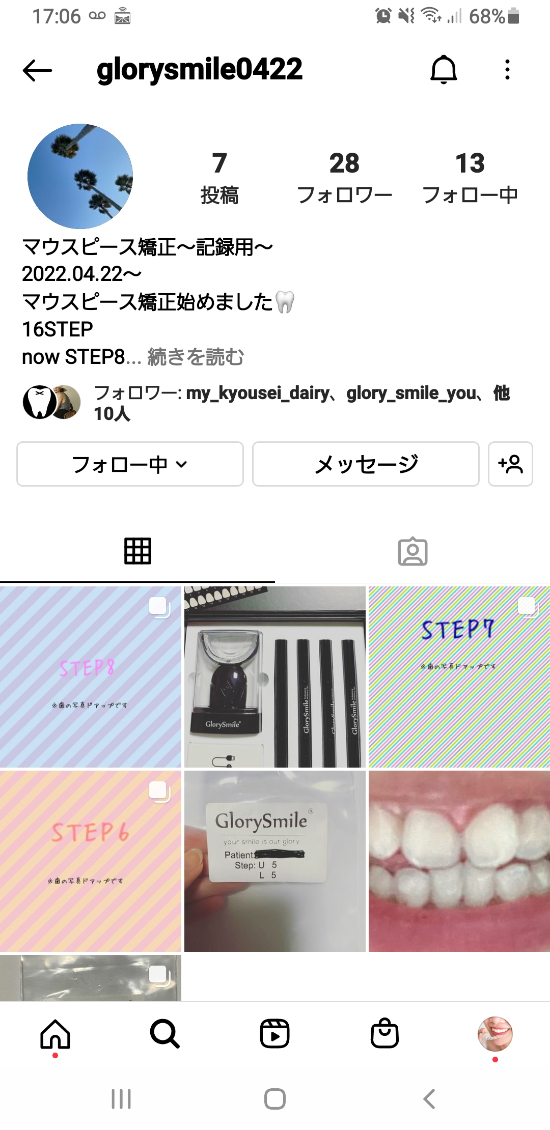 マウスピース矯正始めました